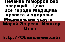 Лечение геморроя без операций › Цена ­ 300 - Все города Медицина, красота и здоровье » Медицинские услуги   . Марий Эл респ.,Йошкар-Ола г.